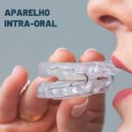 Aparelho Intra-oral
